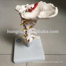 ISO Cervical Wirbelsäule Modell mit Hals Arterie